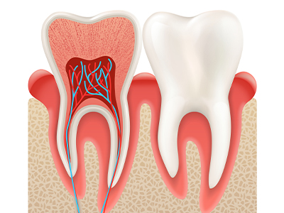 Endodonti (Kanal Tedavisi)